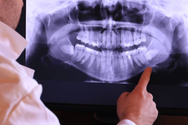 Best Emergency Dental Care for Sports Injuries in Shawnee Hills, OH